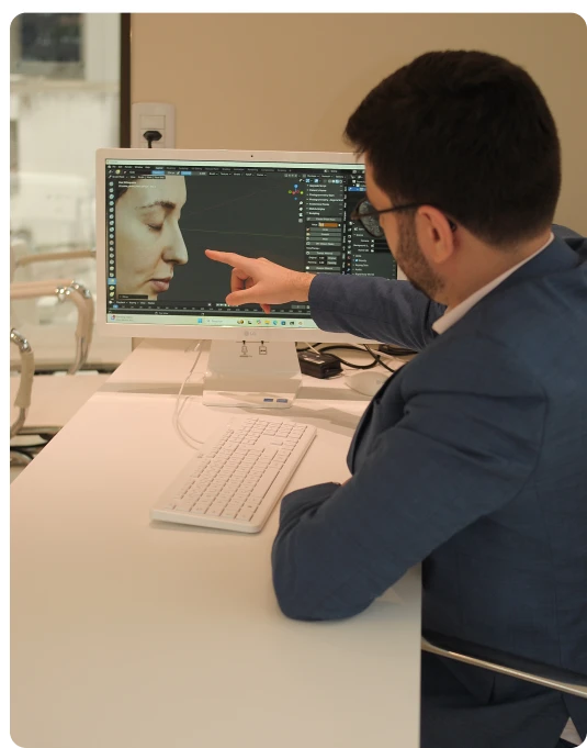 Dr. Lucas Mostardeiro apontando para a simulação digital 3D de uma rinoplastia na tela do computador